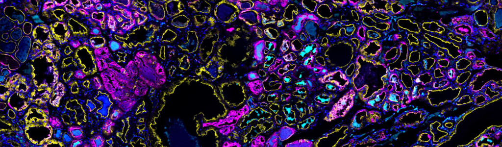 A fluorescence in-situ hybridization and lectin stain image of the accessory nidamental gland in the bobtail squid. (Derrick Kamp photo)