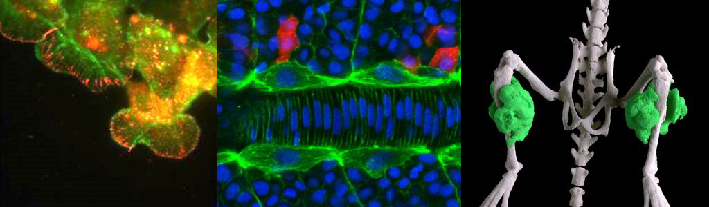 (Left) Image of a pigment cell on a fish scale viewed with transmitted light using a 100-year-old UConn microscope (Juliet Lee) (Center) A cross-section of the lower hind limb of an adult mouse with a genetic mutation that causes Fibro/Adipogenic progenitor (FAP) cells to form cartilage and bone (Russ Hanson) (Right) Host cell microtubules (cyan) forming cages around Toxoplasma gondii parasites (small magenta structures), with host cell nucleus (large magenta structure) (Michael Griffith)