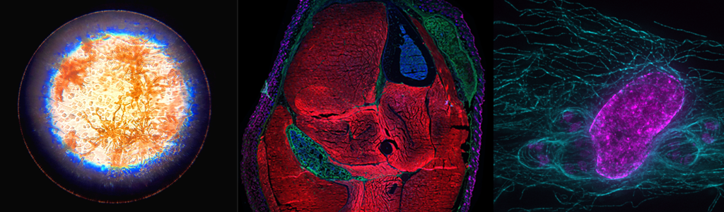 (Left) Image of a pigment cell on a fish scale viewed with transmitted light using a 100-year-old UConn microscope (Juliet Lee) (Center) A cross-section of the lower hind limb of an adult mouse with a genetic mutation that causes Fibro/Adipogenic progenitor (FAP) cells to form cartilage and bone (Russ Hanson) (Right) Host cell microtubules (cyan) forming cages around Toxoplasma gondii parasites (small magenta structures), with host cell nucleus (large magenta structure) (Michael Griffith)