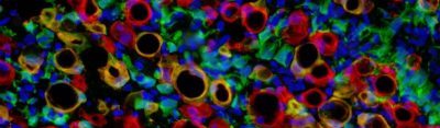 Reprogrammed muscle stem cells and failed skeletal muscle regeneration (Goldhamer Lab)